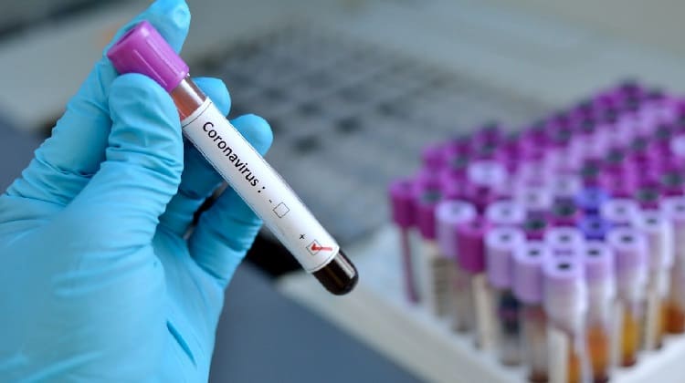 Tasa de mortalidad del coronavirus en Europa